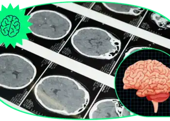 21 Brain Trivia Questions To Tease The Aspiring Neurologist