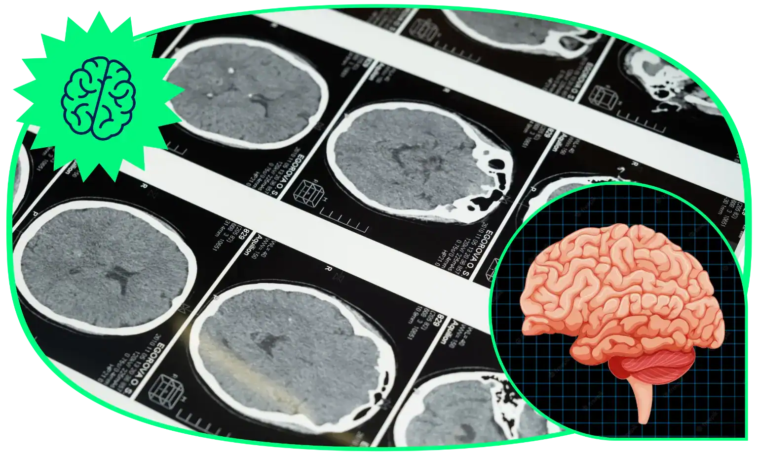 21 Brain Trivia Questions To Tease The Aspiring Neurologist